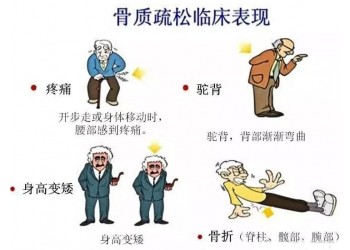 你知道骨質疏松癥對你的生活有哪些影響嗎？